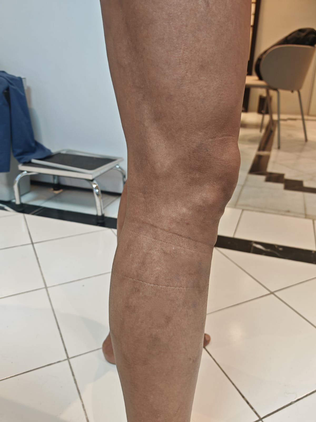 Caso 1 después del tratamiento